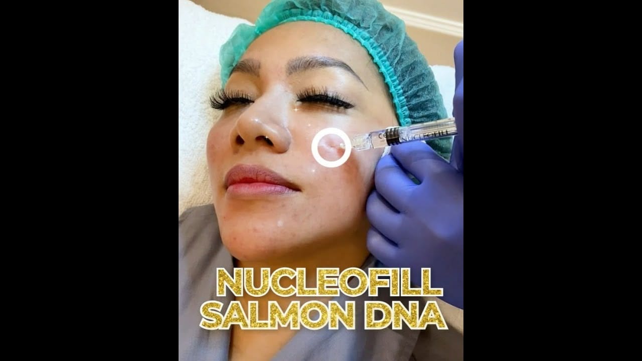 Picture of a woman's face getting dermal injections to their cheek at blink beauty clinic.