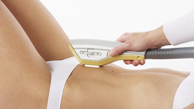 Picture of a girl getting hair removal treatment at Blink Beauty Clinic by IPL Exilite