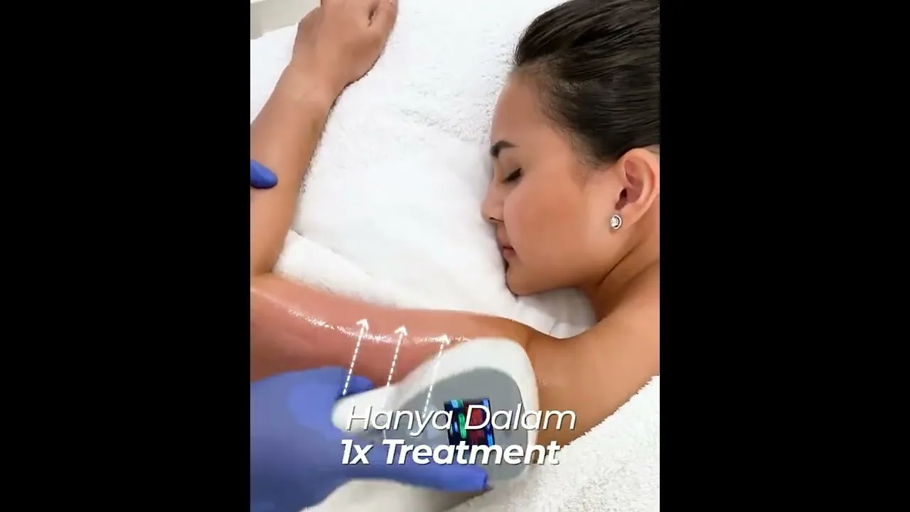 Picture of a woman lying down face first getting exilistrat treatment at Blink Beauty Clinic