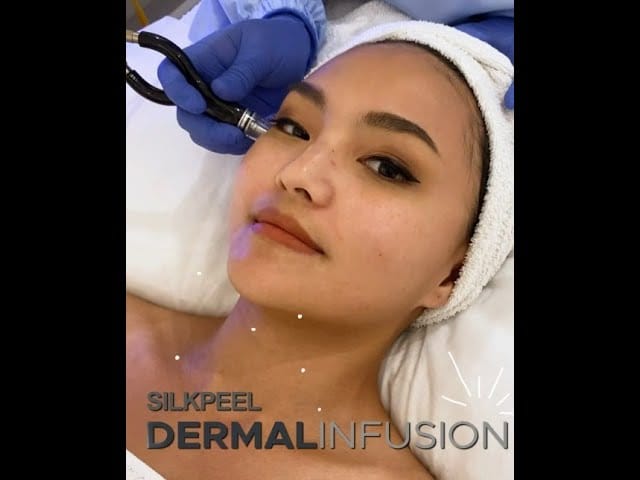 Picture of a woman getting silkpeel dermal infusion treatment at Blink Beauty clinic.