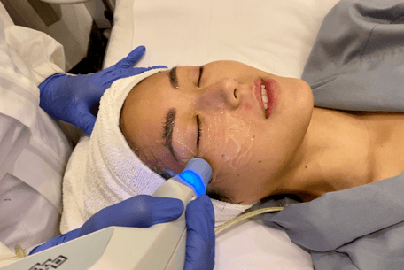 Close up of Ling Ling Bakrie smiling at the camera whilst getting silkpeel treatment at Blink Beauty Clinic.