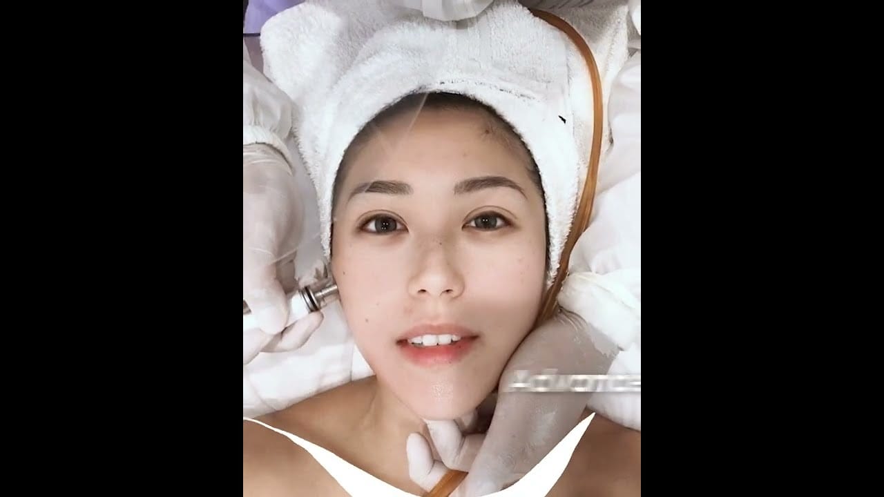 Close up of Ling Ling Bakrie smiling at the camera whilst getting silkpeel treatment at Blink Beauty Clinic.